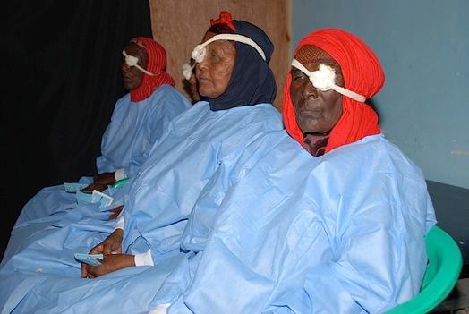 More Somalis undergo cataract surgery