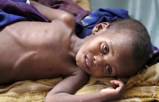 Droughts bring famine to Horn of Africa