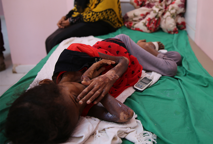 "Yemen’deydim, durum kötü"